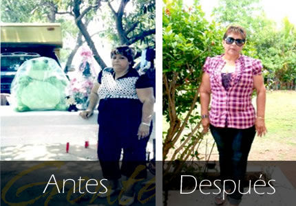 Rafaela Martinez Gonzalez bajo 32 kilos en 3 meses.
